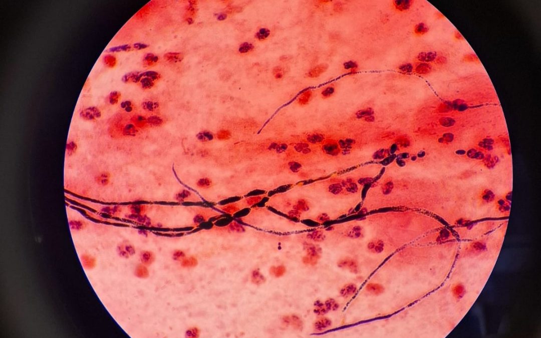Mengenal Patogen Mikoorganisme Penyebab Infeksi Saluran Pernafasan pada Anak