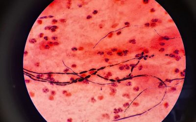 Mengenal Patogen Mikoorganisme Penyebab Infeksi Saluran Pernafasan pada Anak