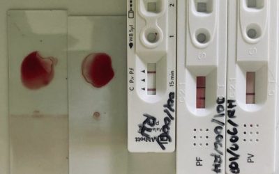 Target 2030: Melawan Kecacingan dan Malaria Demi SDGs Indonesia